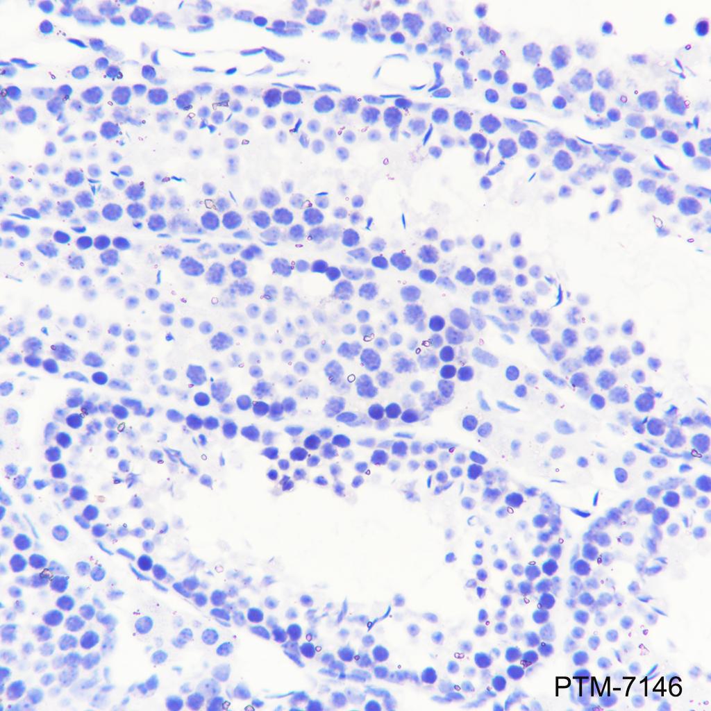Anti-TBR1 Rabbit mAb
