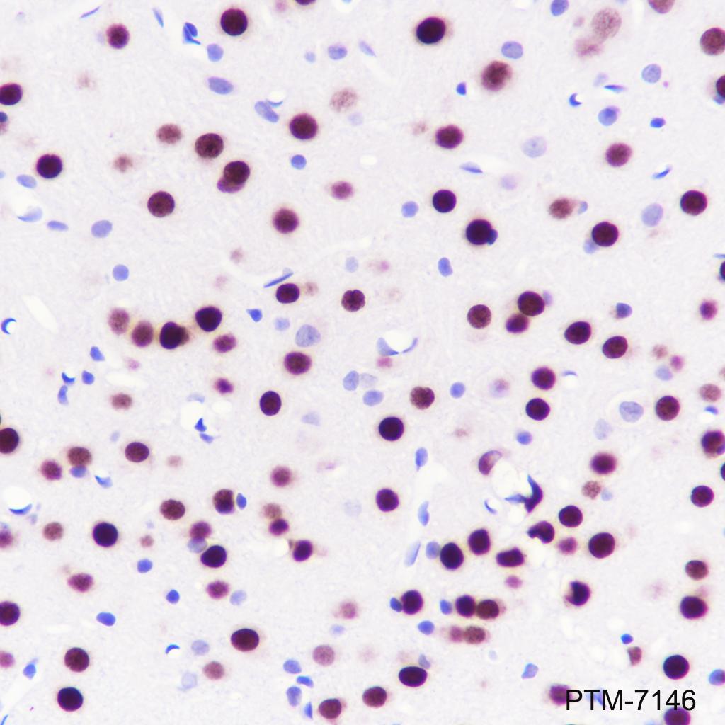 Anti-TBR1 Rabbit mAb
