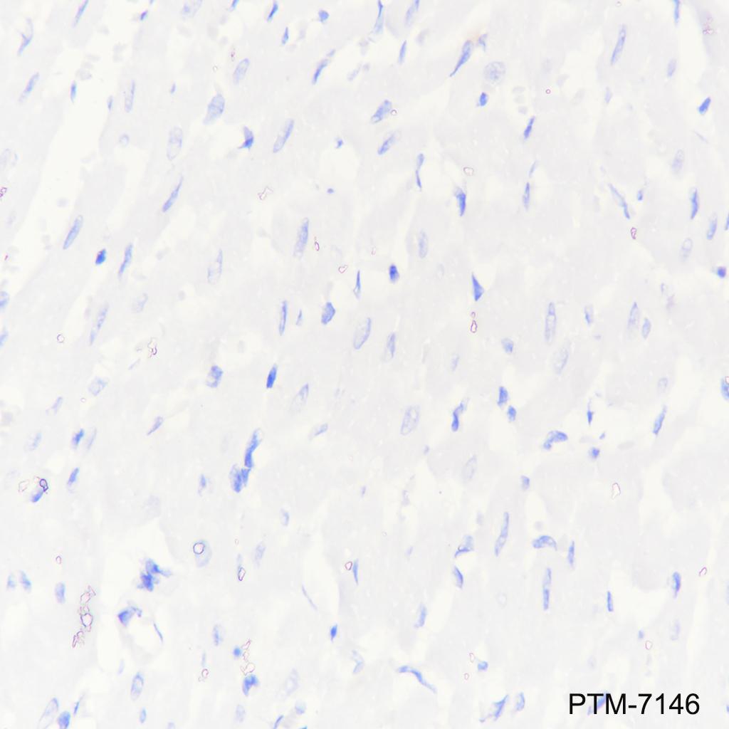 Anti-TBR1 Rabbit mAb