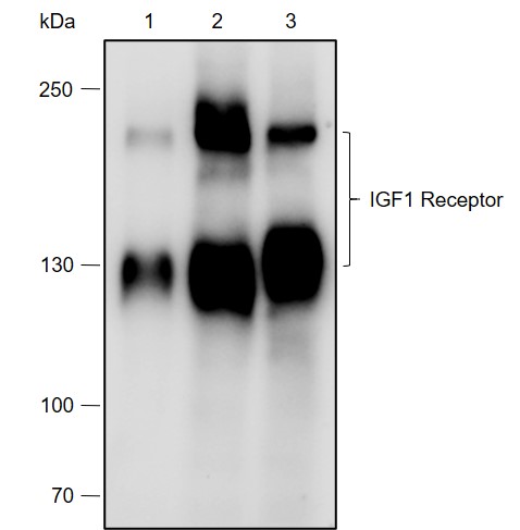 Anti-IGF1 Receptor Rabbit mAb
