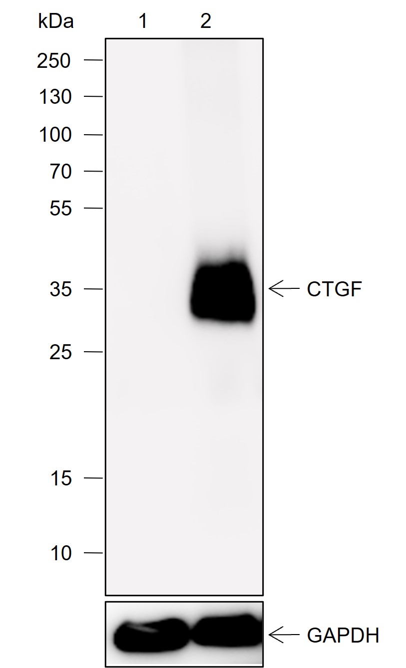 Anti-CTGF Rabbit mAb