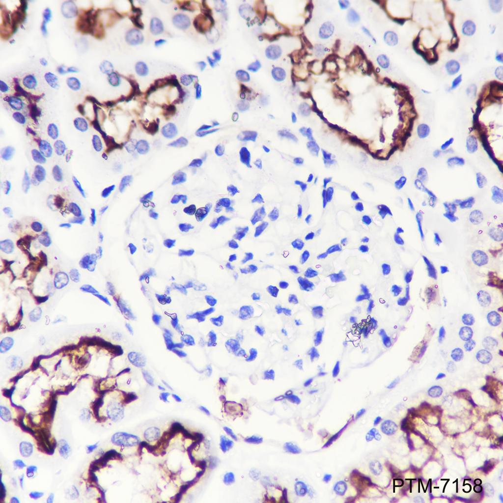 Anti-ACE2 Rabbit mAb