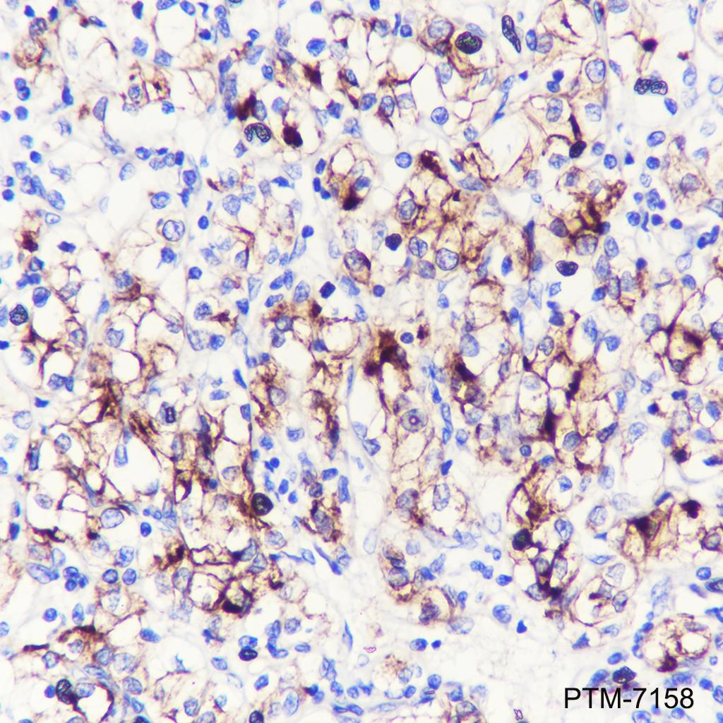 Anti-ACE2 Rabbit mAb