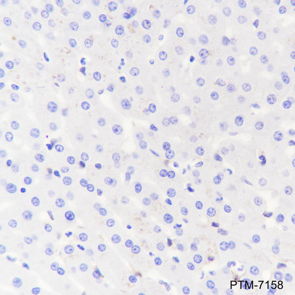 Anti-ACE2 Rabbit mAb