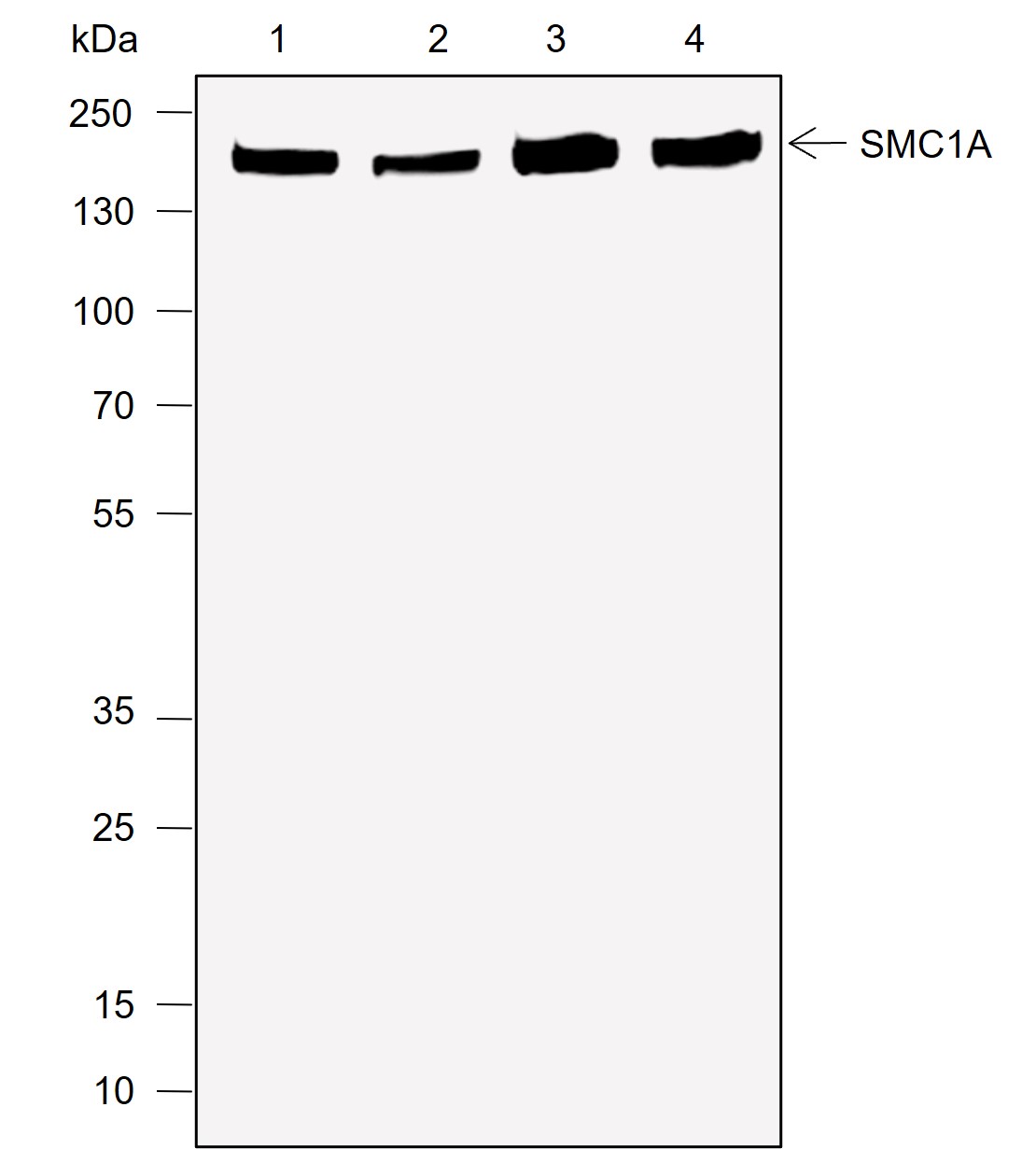 Anti-SMC1A Rabbit mAb