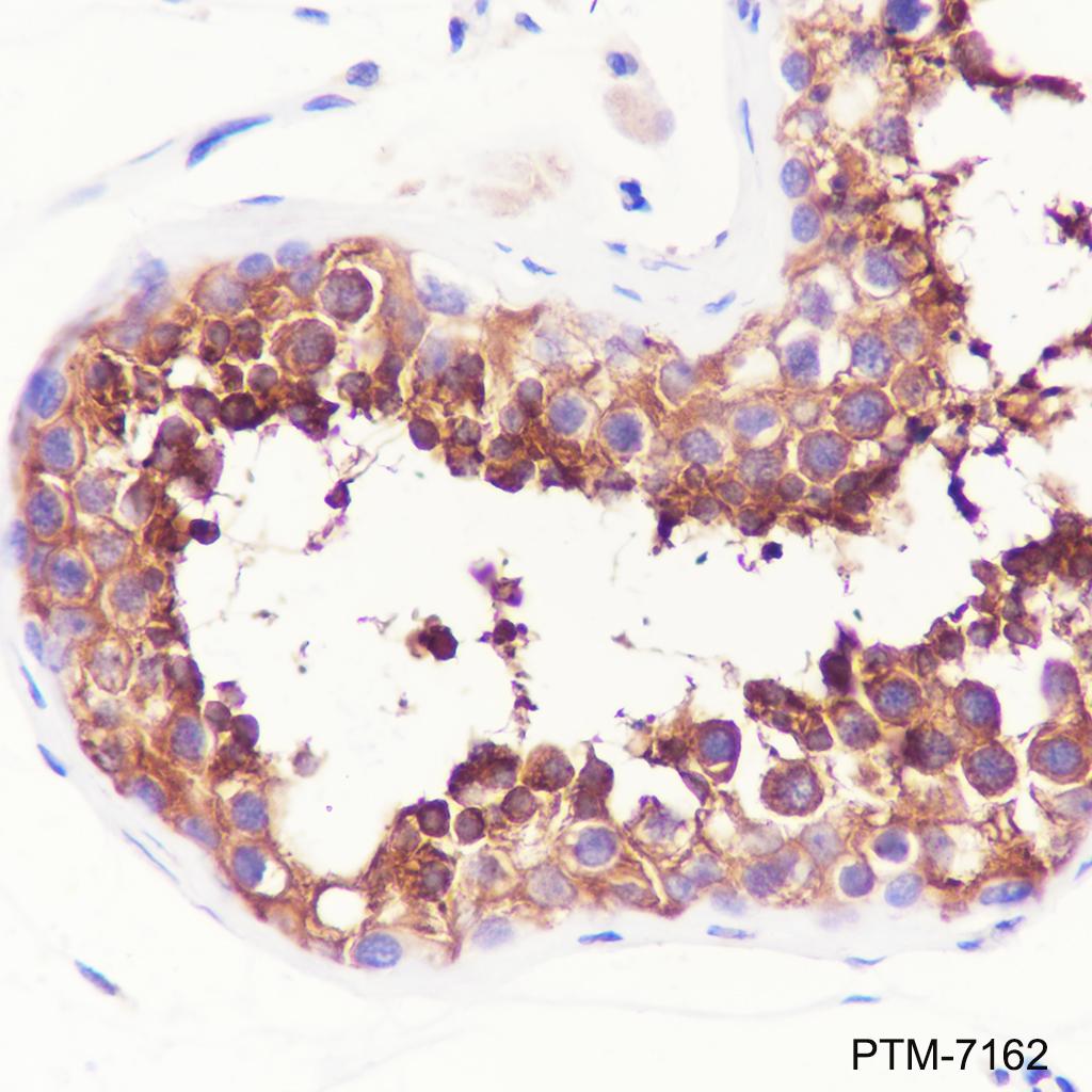 Anti-PKA C-alpha Mouse mAb