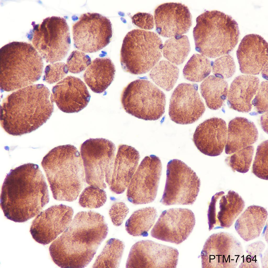 Anti-Ryanodine Receptor Rabbit mAb