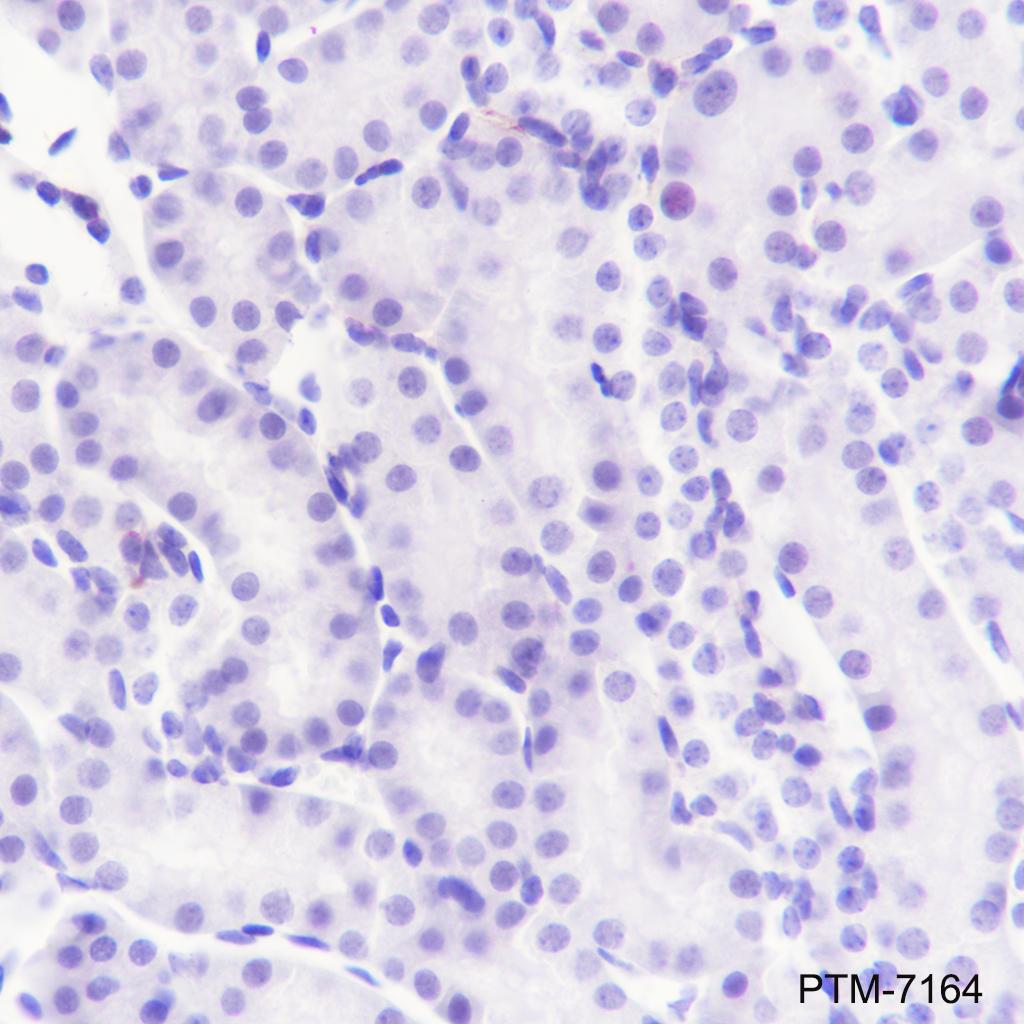 Anti-Ryanodine Receptor Rabbit mAb