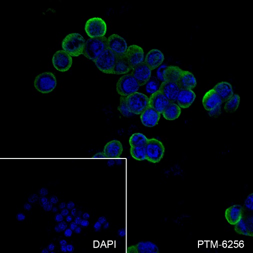 Anti-DOPA Decarboxylase / DDC Rabbit mAb