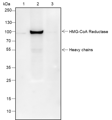 Anti-HMGCR Rabbit mAb