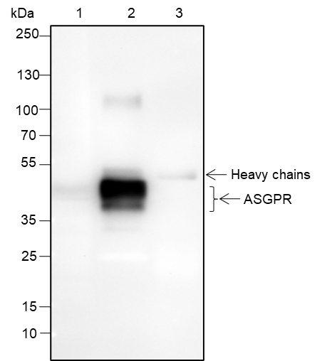 Anti-ASGR1 Rabbit mAb