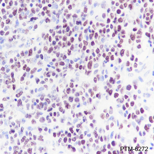 Anti-EZH2 Rabbit mAb