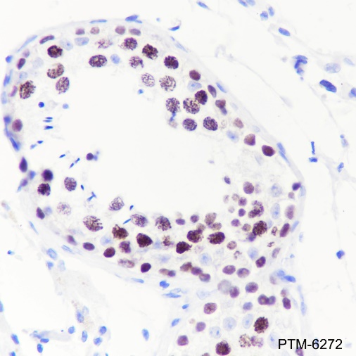 Anti-EZH2 Rabbit mAb