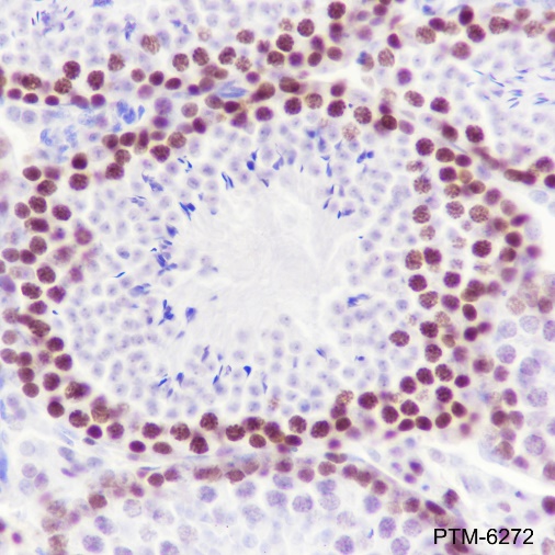 Anti-EZH2 Rabbit mAb