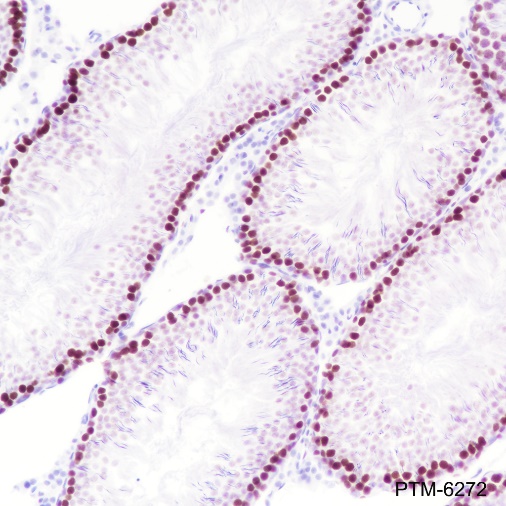 Anti-EZH2 Rabbit mAb