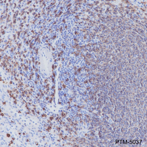 Anti-CD20 Rabbit mAb