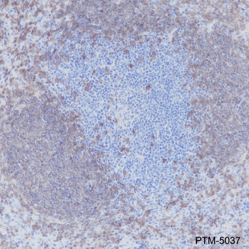 Anti-CD20 Rabbit mAb