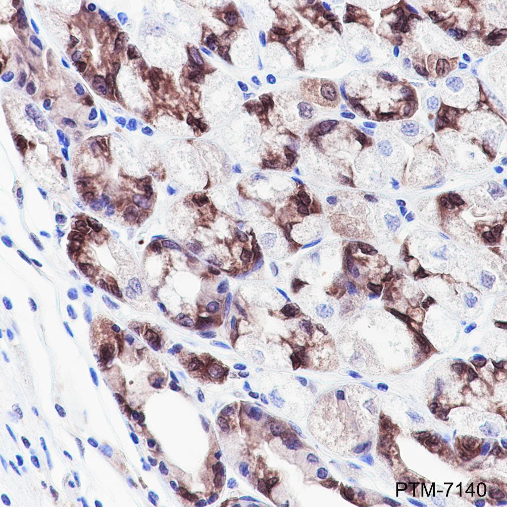 Anti-GST3/GSTP1 Rabbit mAb