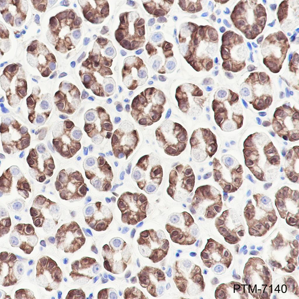 Anti-GST3/GSTP1 Rabbit mAb