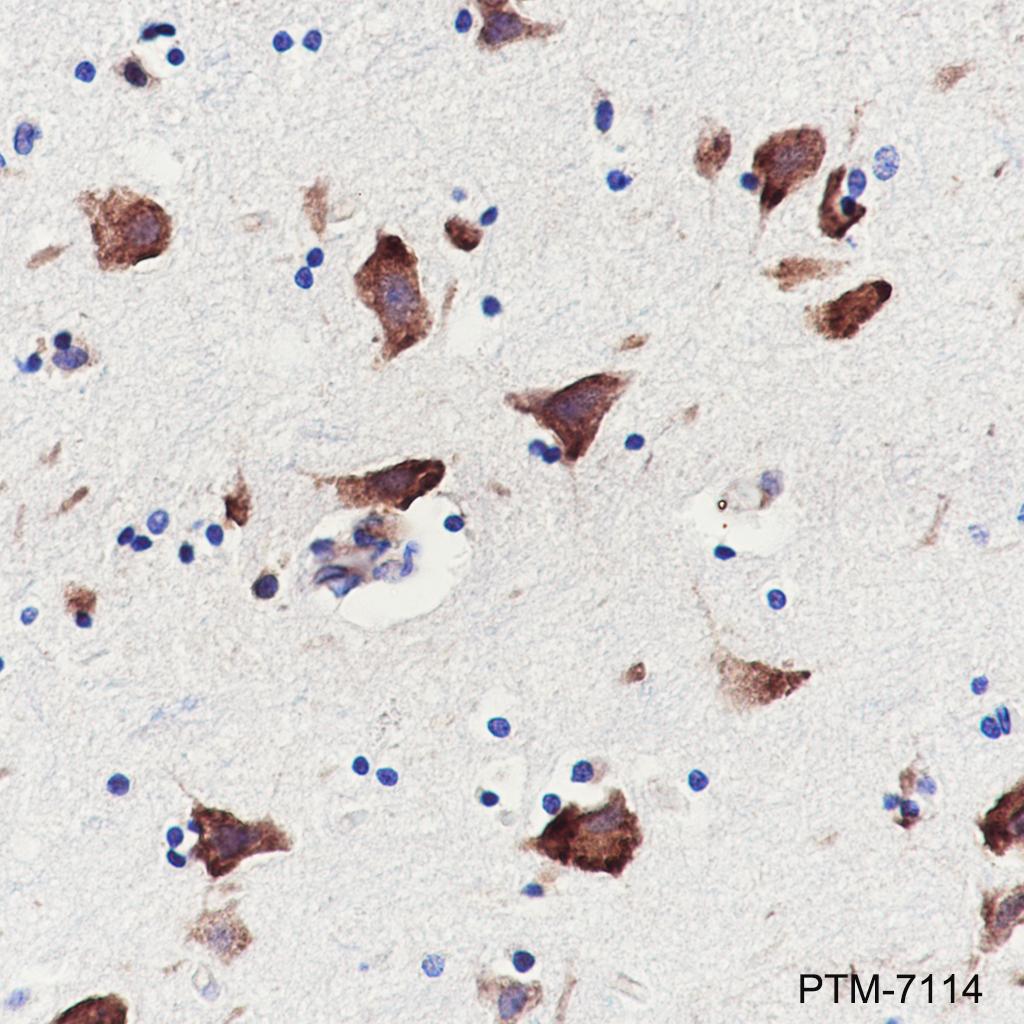 Anti-eEF1A2 Rabbit mAb
