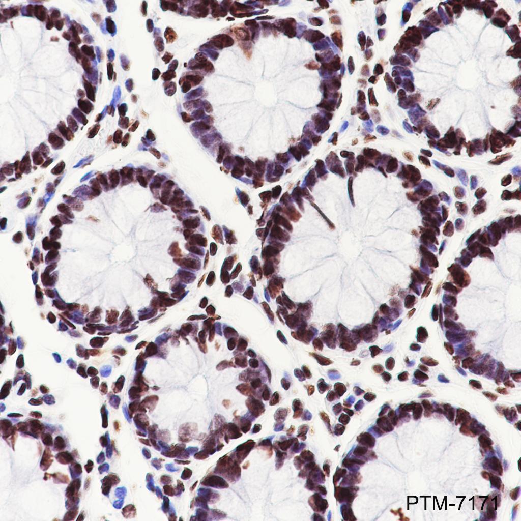 Anti-Nucleolin Rabbit mAb