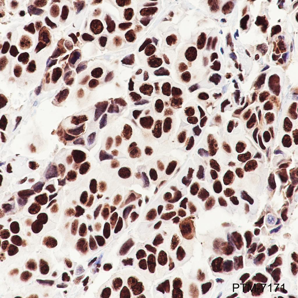 Anti-Nucleolin Rabbit mAb