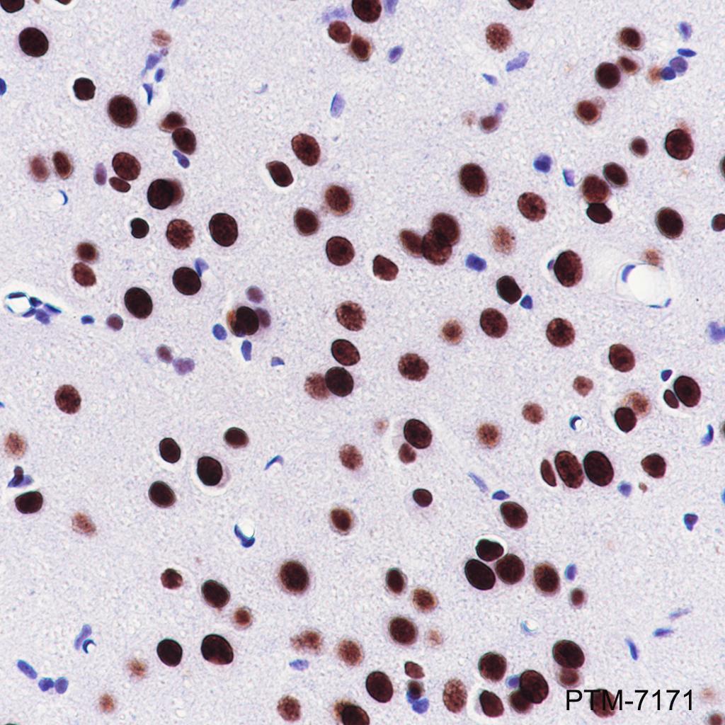Anti-Nucleolin Rabbit mAb