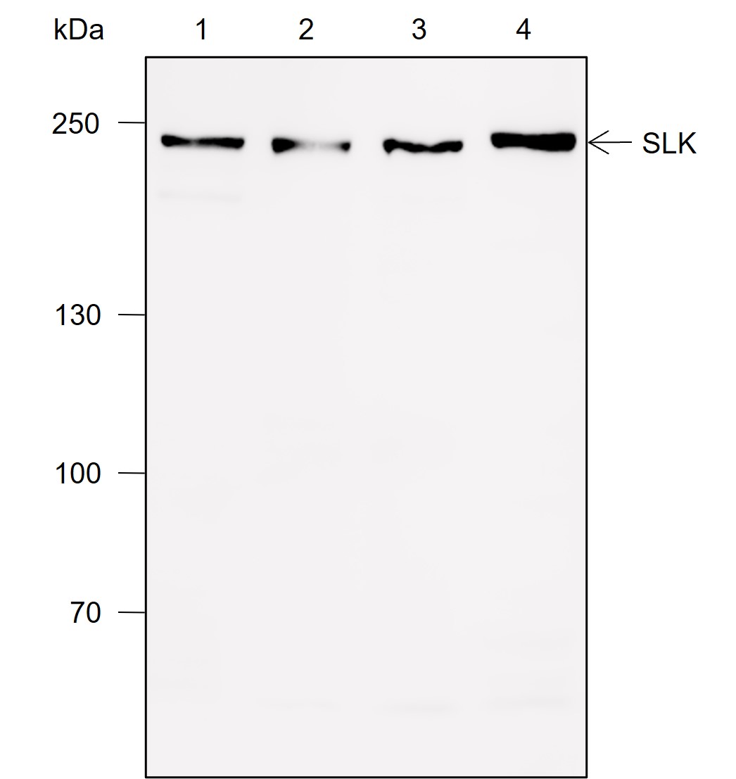 Anti-SLK Mouse mAb