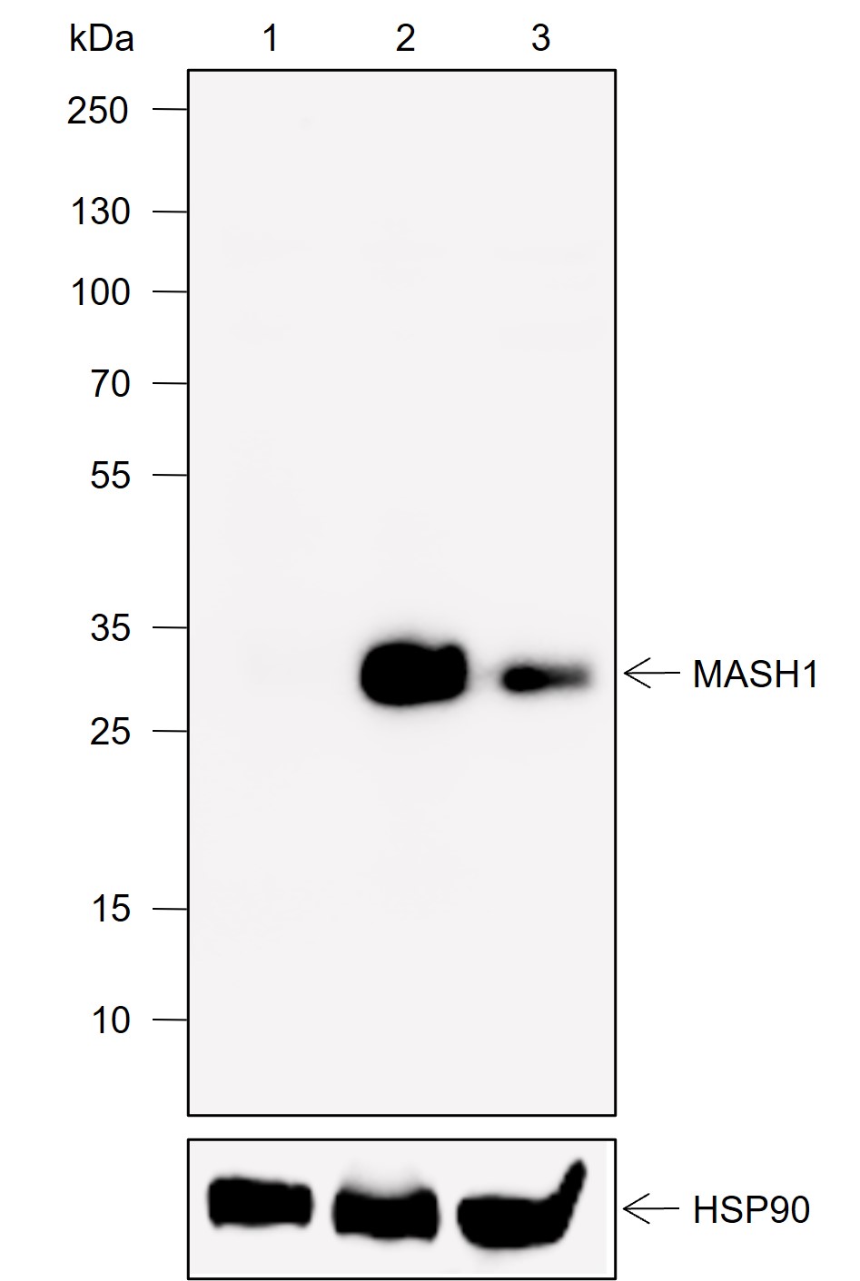Anti-MASH1 Rabbit mAb