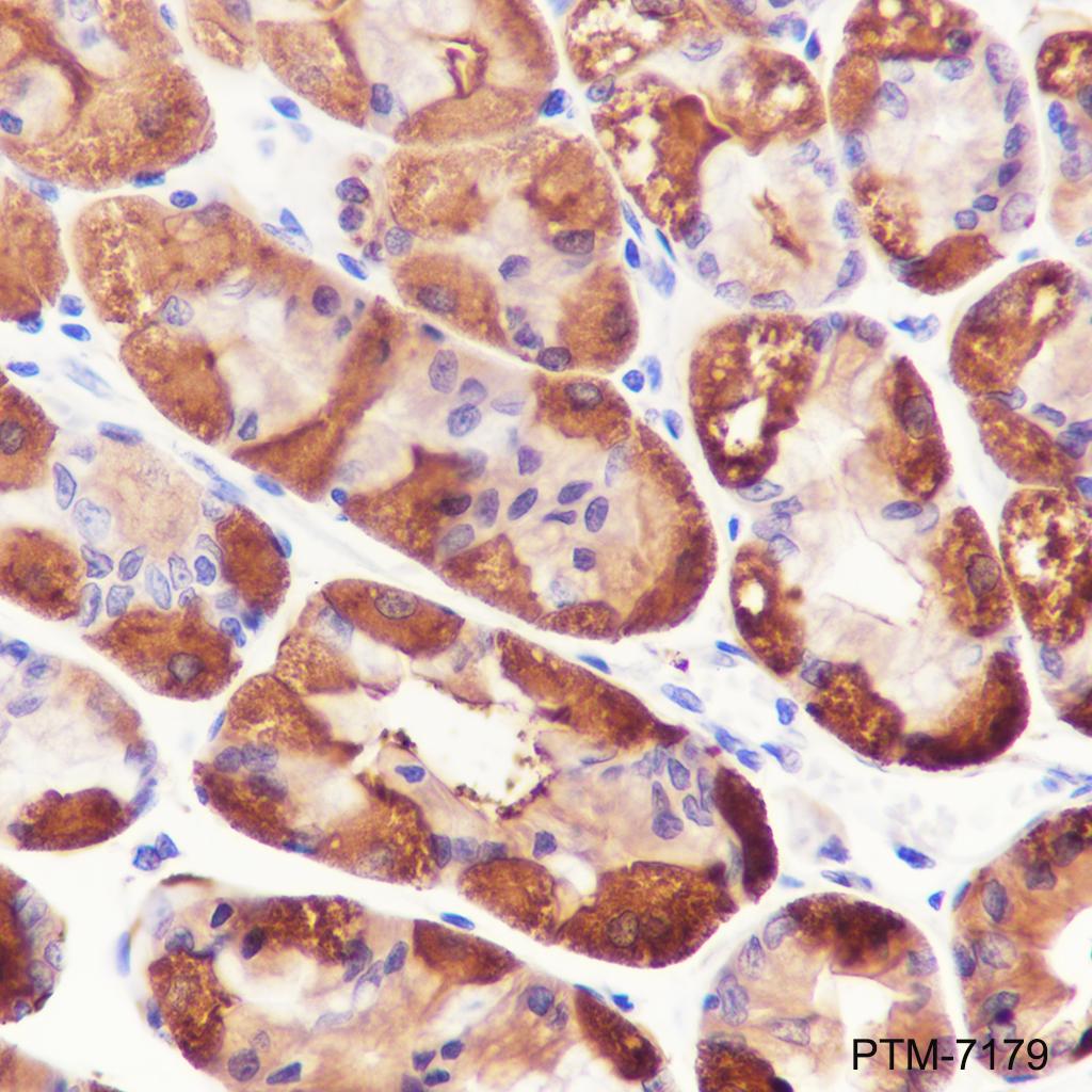 Anti-ALDH1A1 Rabbit mAb