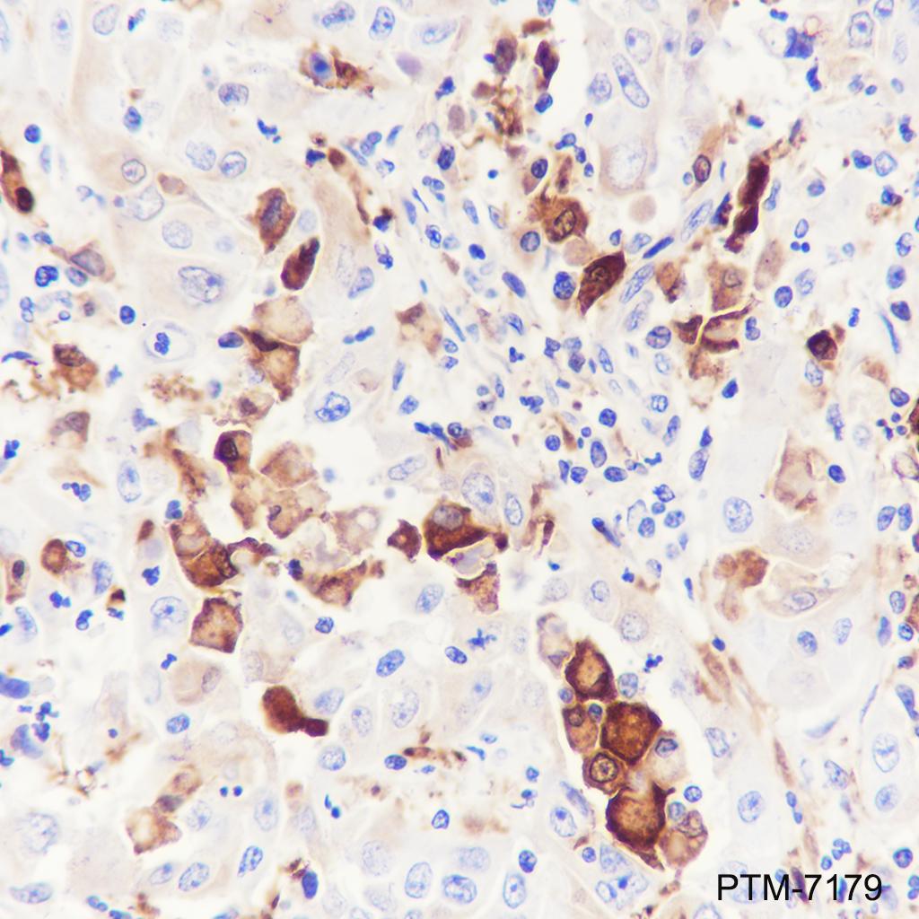 Anti-ALDH1A1 Rabbit mAb