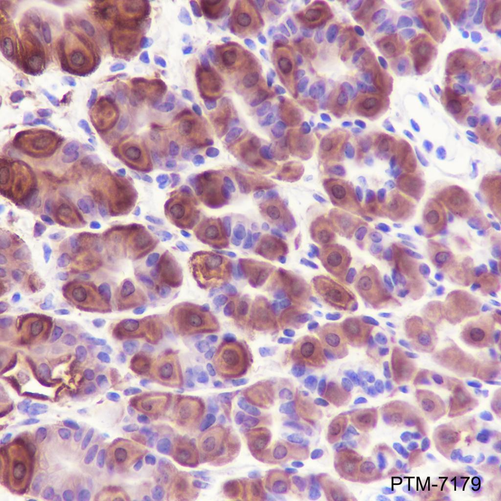 Anti-ALDH1A1 Rabbit mAb