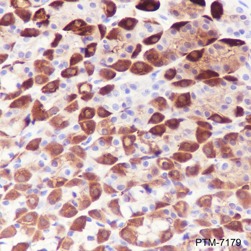 Anti-ALDH1A1 Rabbit mAb