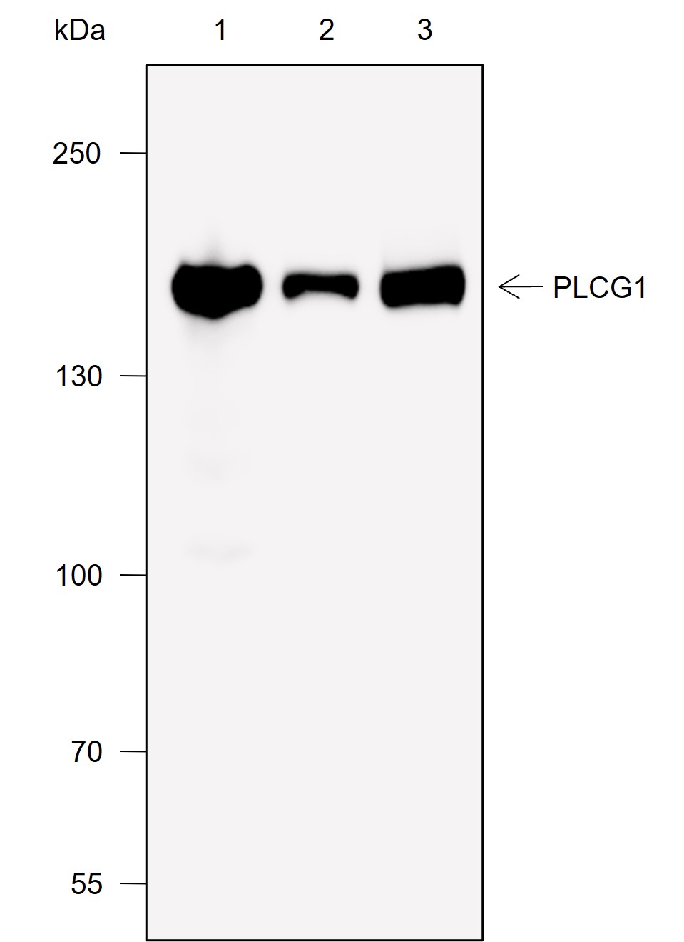 Anti-PLCG1 Rabbit mAb