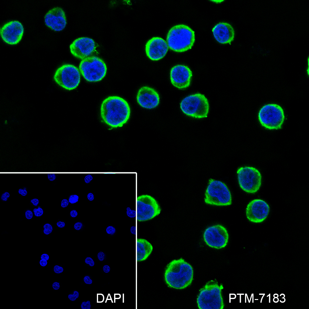 Anti-DcR1 Rabbit mAb