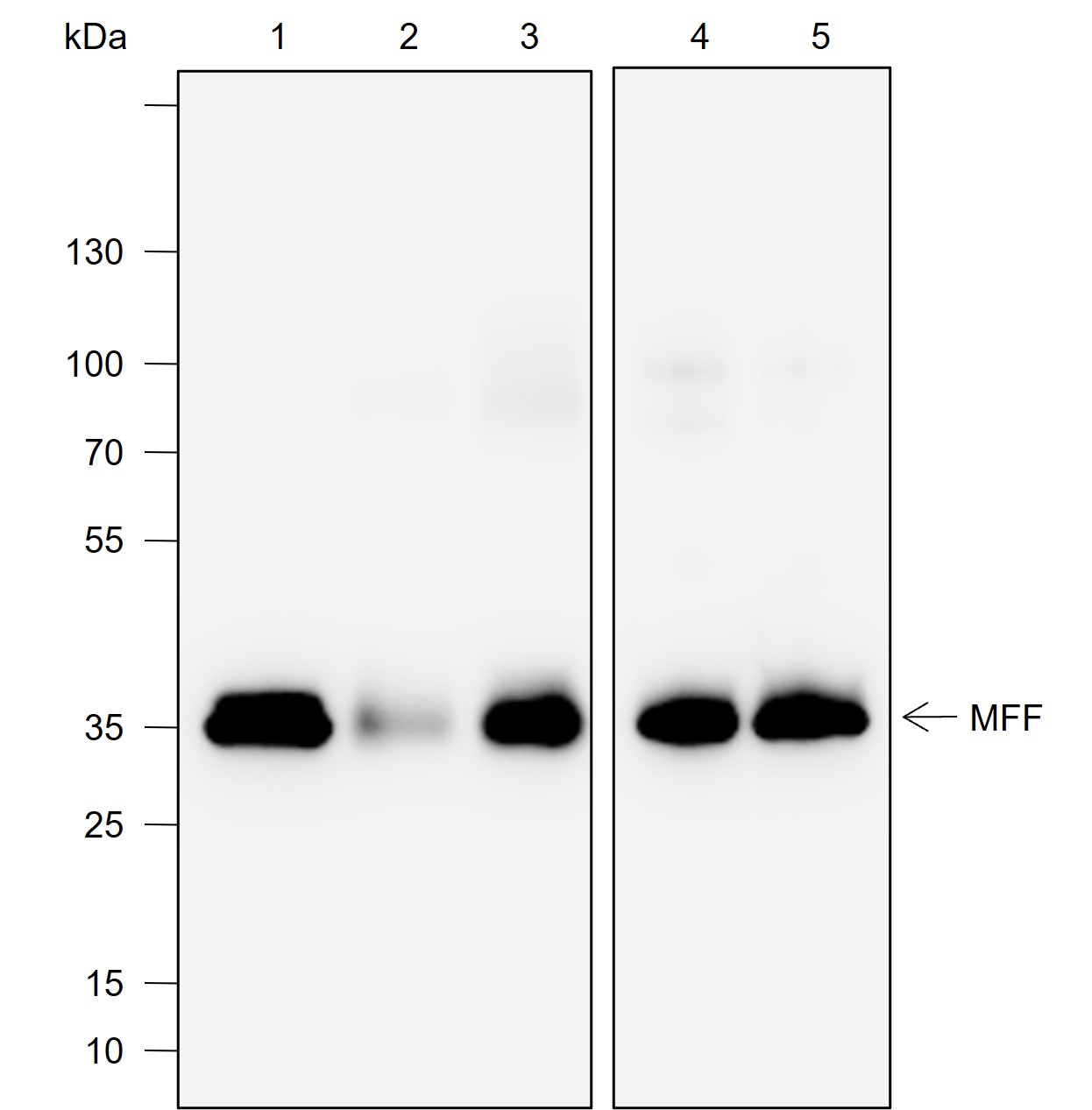 Anti-MFF Rabbit mAb