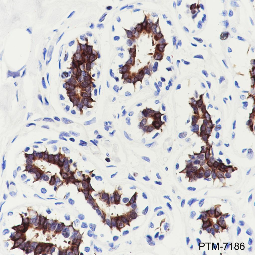 Anti-Tau(phospho s396) Rabbit mAb