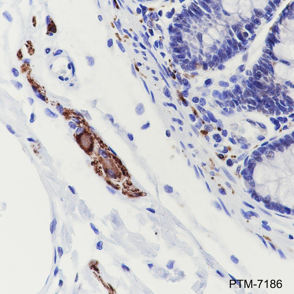 Anti-Tau(phospho s396) Rabbit mAb