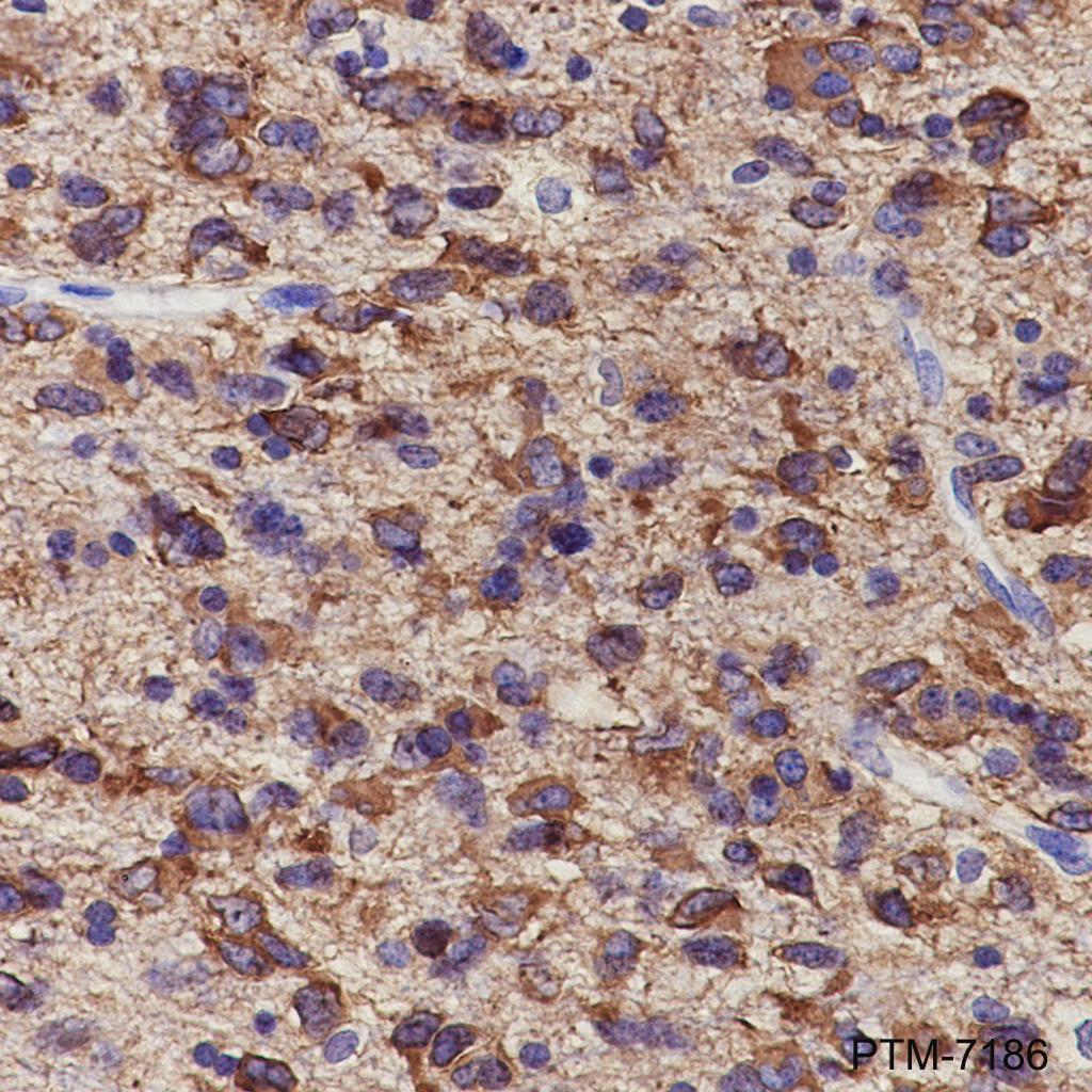 Anti-Tau(phospho s396) Rabbit mAb