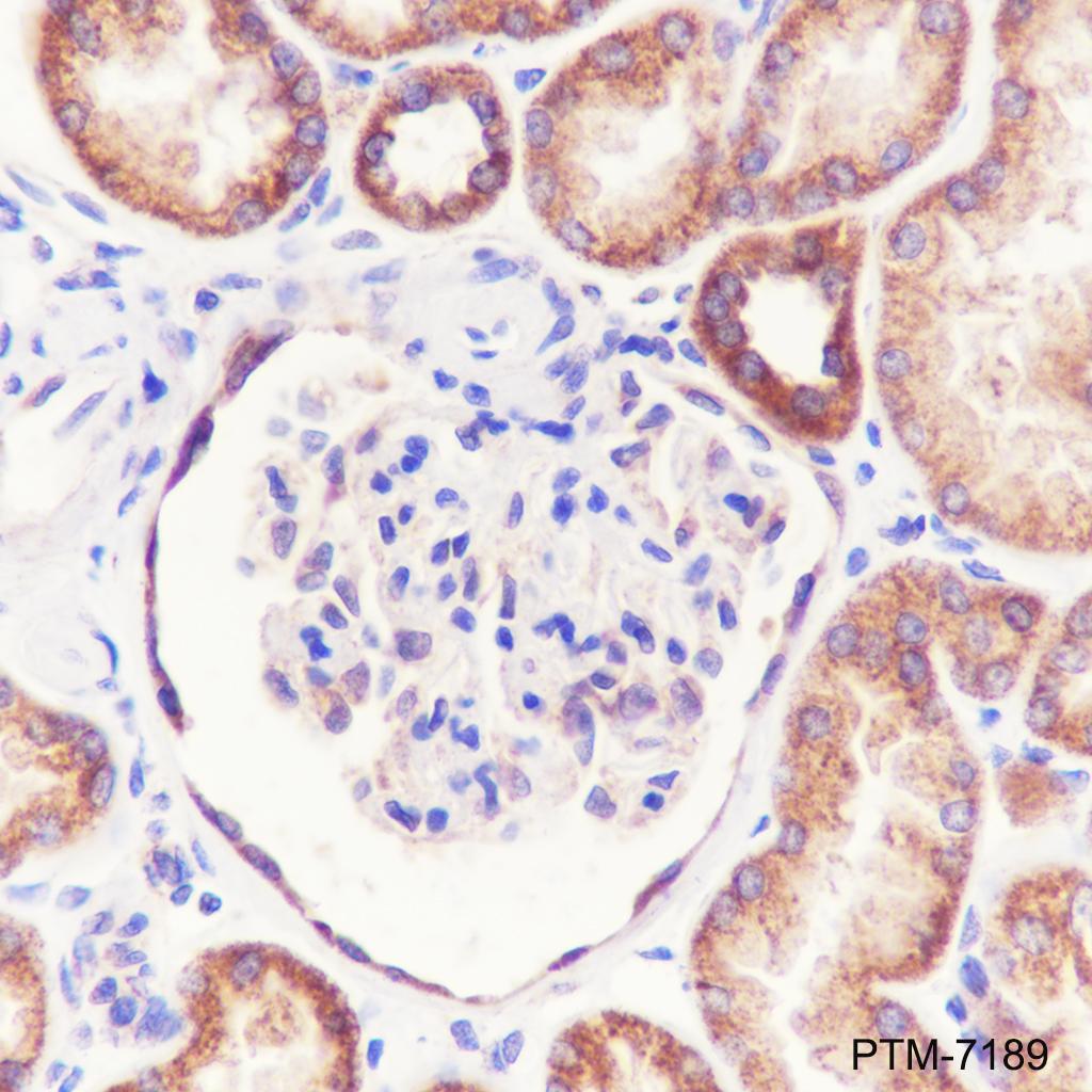 Anti-NDUFS3 Rabbit mAb