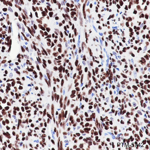 Anti-FOXL2 Rabbit mAb