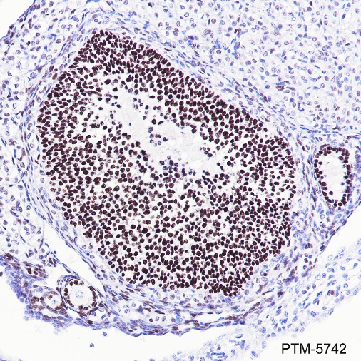 Anti-FOXL2 Rabbit mAb