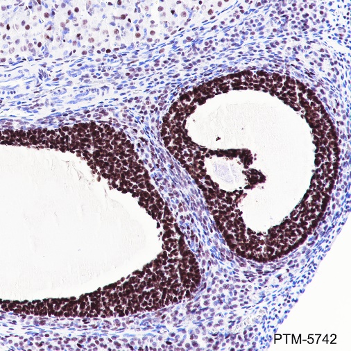 Anti-FOXL2 Rabbit mAb
