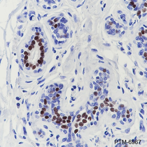 Anti-Estrogen Receptor alpha Rabbit mAb