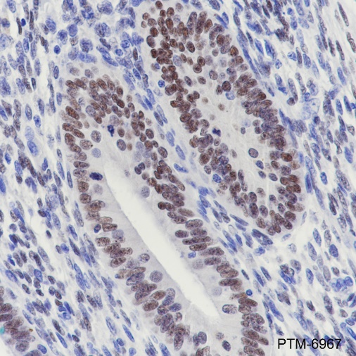 Anti-Estrogen Receptor alpha Rabbit mAb