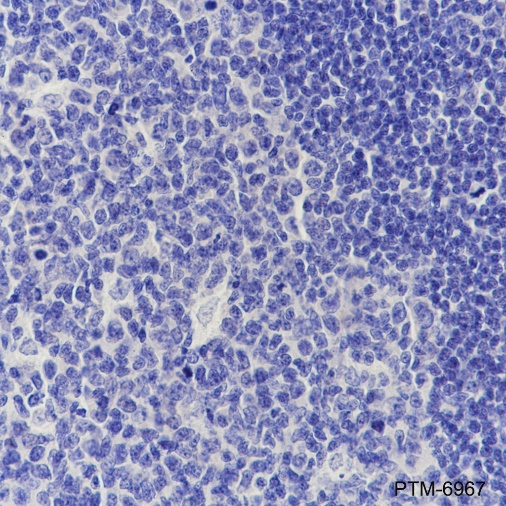 Anti-Estrogen Receptor alpha Rabbit mAb