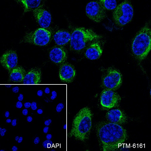 Anti-Dynamin 1 Rabbit mAb