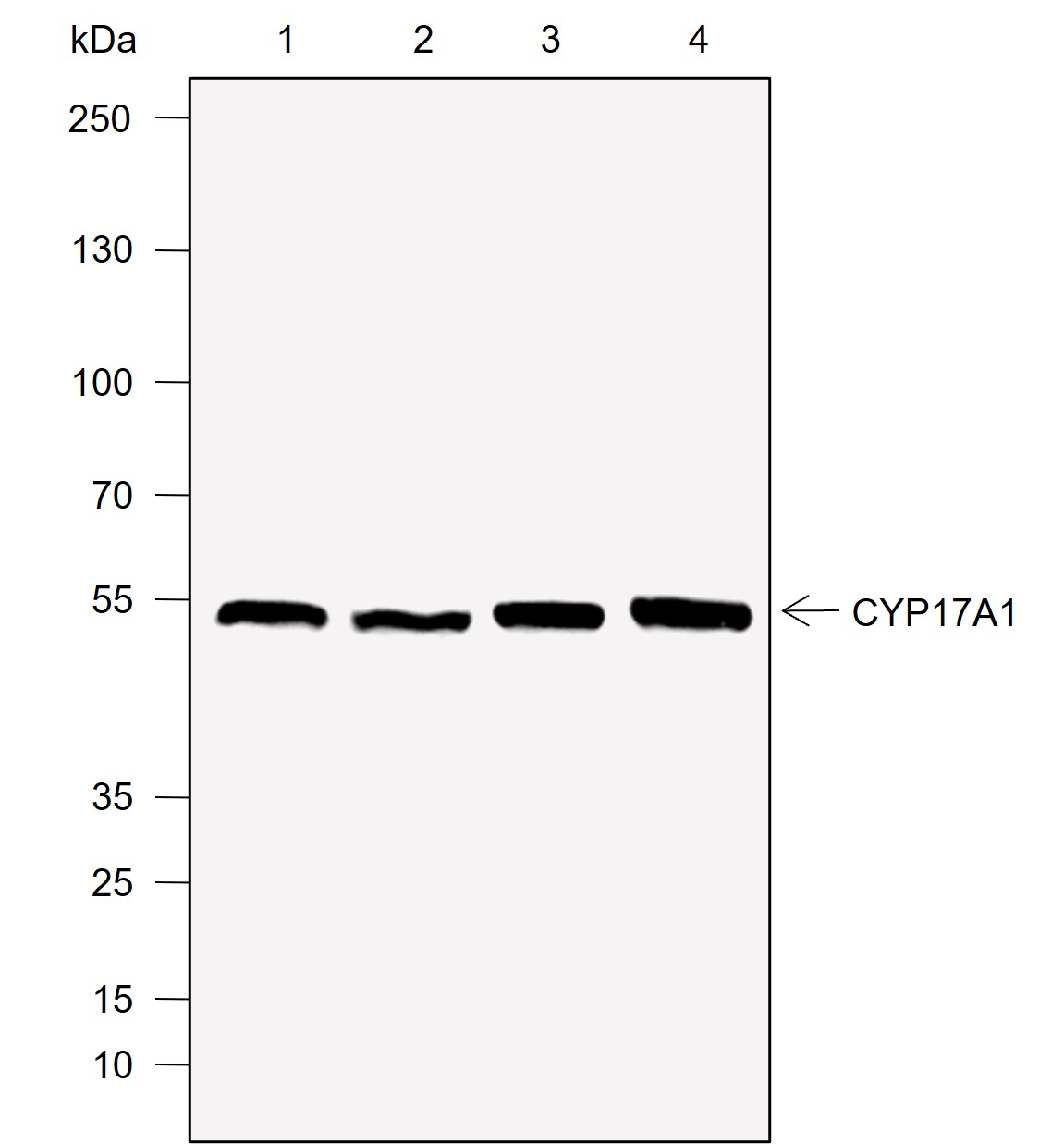 Anti-CYP17A1 Rabbit mAb