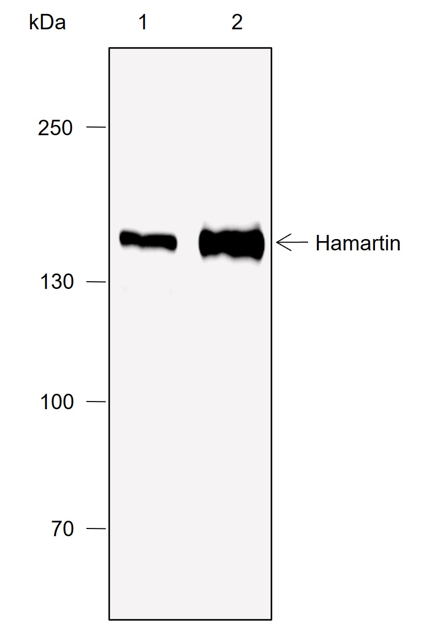 Anti-Hamartin Rabbit mAb