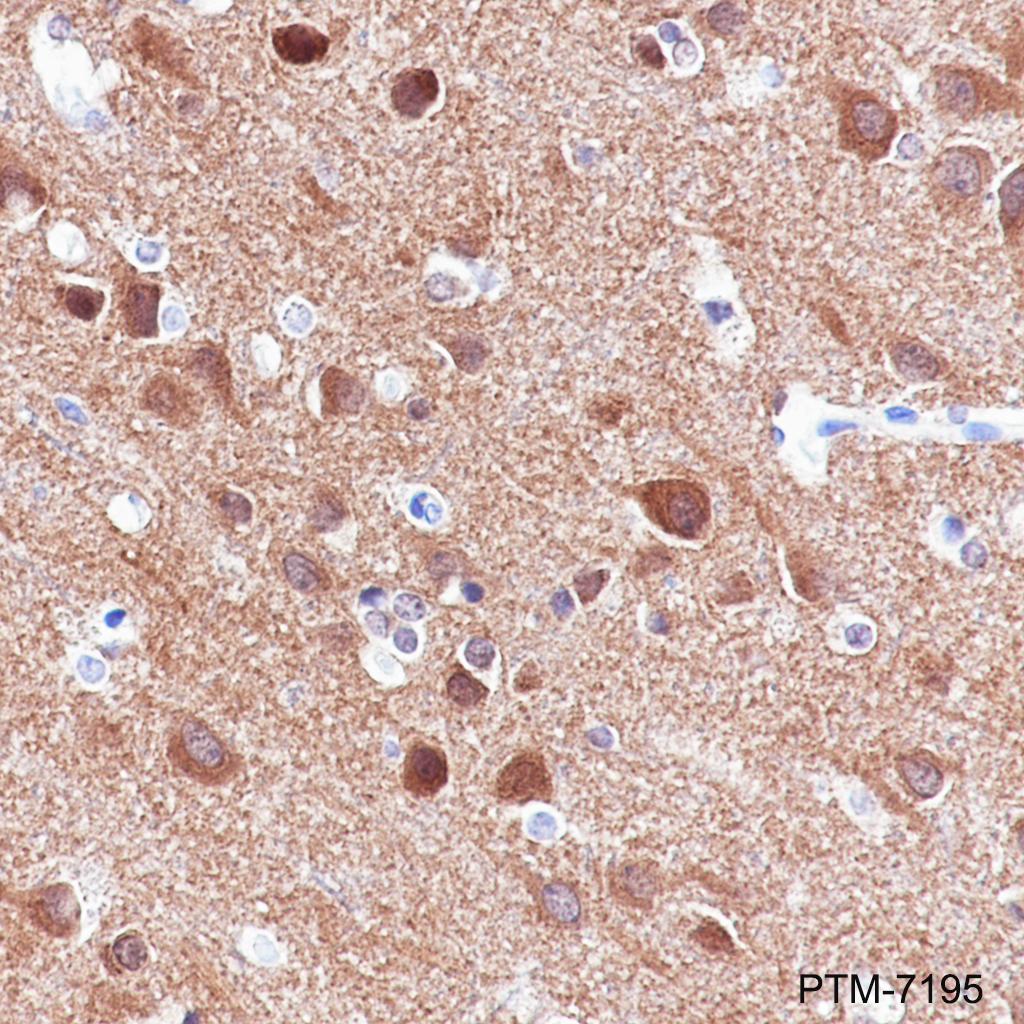 Anti-DNAJC6 Rabbit mAb